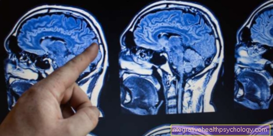 Pregled lubanje i mozga pomoću MRI