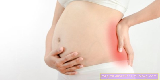 Herniated plate under graviditet