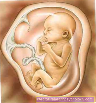 Amniotický vak