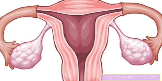 Běžné ovariální choroby