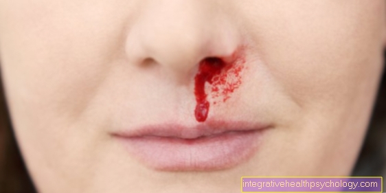 Kraujavimas iš nosies nėštumo metu
