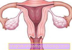Surgical removal of the uterus