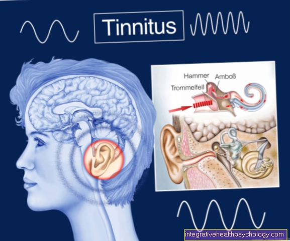 Symptomer på tinnitus