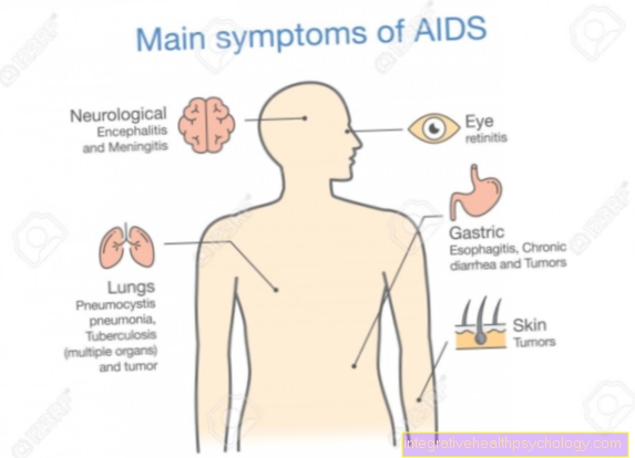 Príznaky AIDS