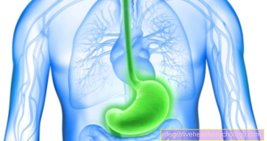 Chronic gastritis