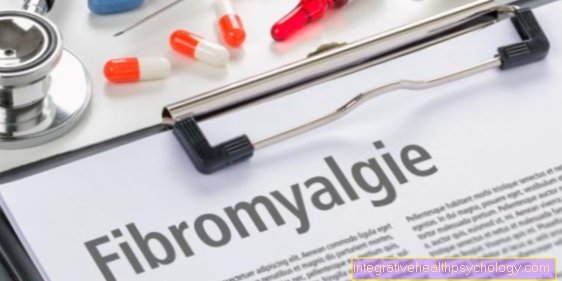 Fibromialģija