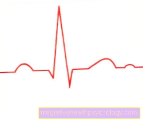Konsekvenser av hjärtrytmier