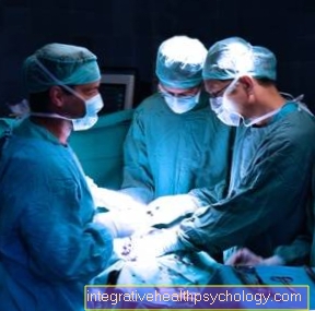 Тривалість життя трансплантації нирок
