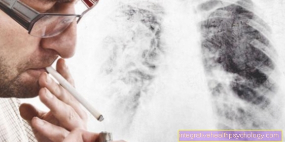 A tüdő laphámsejtes karcinóma?