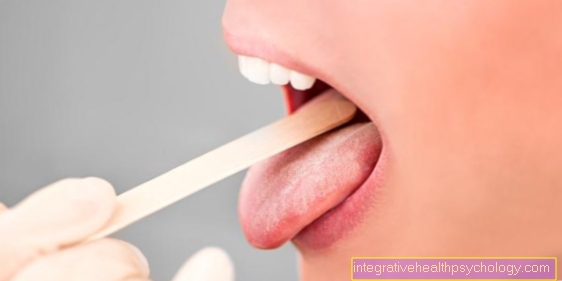 Плоскоклетъчен карцином на езика