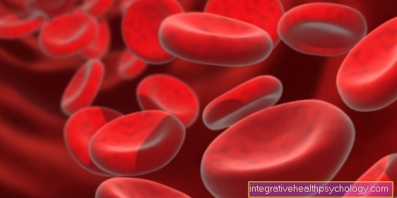 Sickle Cell Anemia - How Dangerous Is It Really?