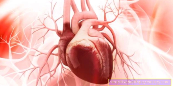 Terapie aortální aneuryzmy