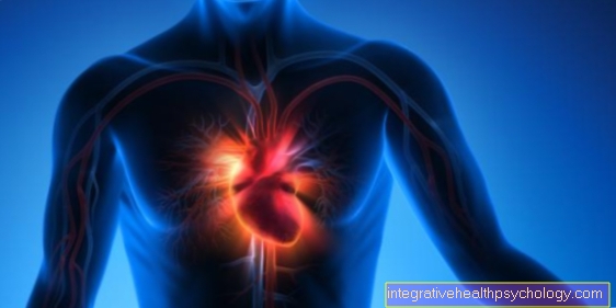 أسباب التهاب عضلة القلب
