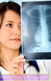 Mitkä ovat keuhkokuumeen merkkejä?