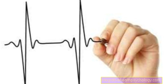 What changes can be seen in the ECG with atrial fibrillation?