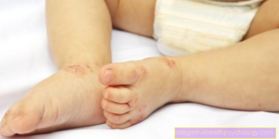 Hand, mouth and foot disease