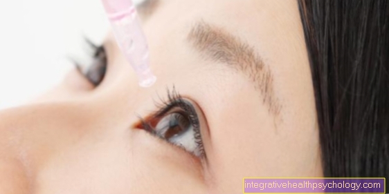 Eye drops containing glucocorticoids