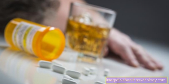Ibuprofenas ir alkoholis - ar jie suderinami?