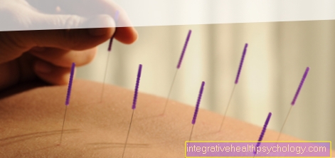 Acupuncture indications