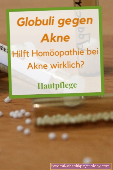 Homeopathy for acne