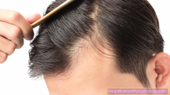 Homeopatia hiustenlähtöön vaihdevuodetta käyttäneillä naisilla