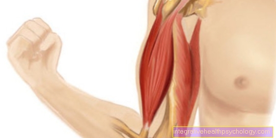 Muscle twitching in the upper arm