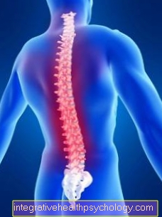 Treatment of a herniated disc through physiotherapy