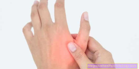 Torn ligament on the finger