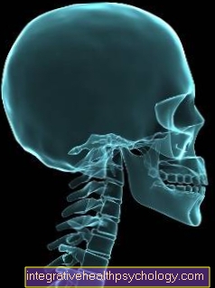 Diagnosing a vertebral fracture