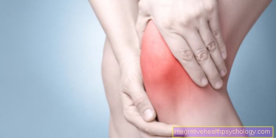 Innvendig ligamentstrekning ved kneet