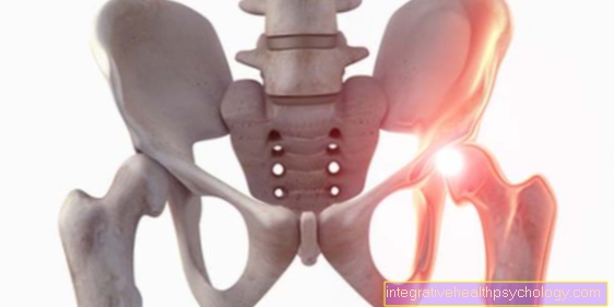 Hip osteoarthritis surgery