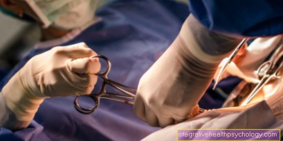Operation of a tennis elbow