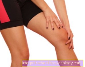 Остеохондроз розрізує коліно