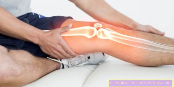 Osteonekróza v kolene