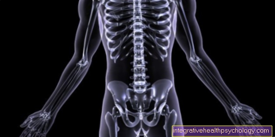 Osteoporos i undervikt