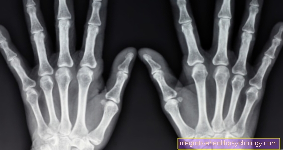 Thumb joint pain