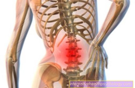 Estenosis del canal espinal en la columna lumbar
