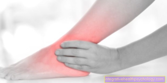 Symptoms of a ligament stretch