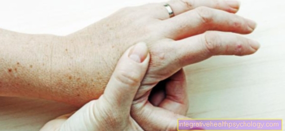 What is finger osteoarthritis?