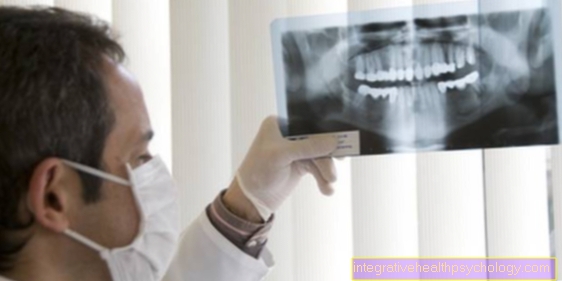 Aggressiivinen periodontaalinen sairaus