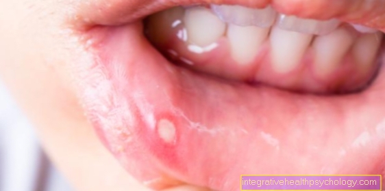 Vesicles in the mouth