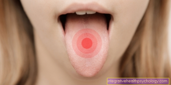 Печіння на кінчику язика
