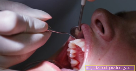 Root canal treatment on the incisor