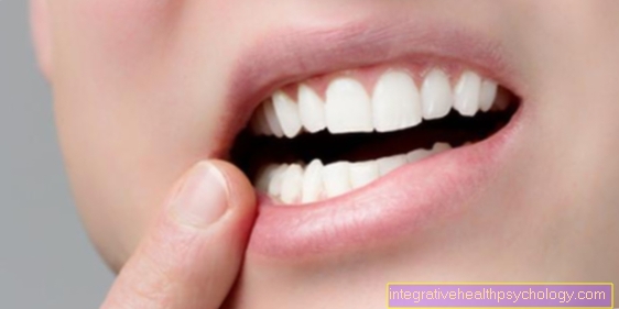 Odstranění zubního implantátu