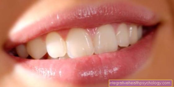 Inflammation of the corners of the mouth