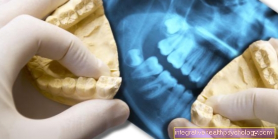 Inflammation after a wisdom tooth operation