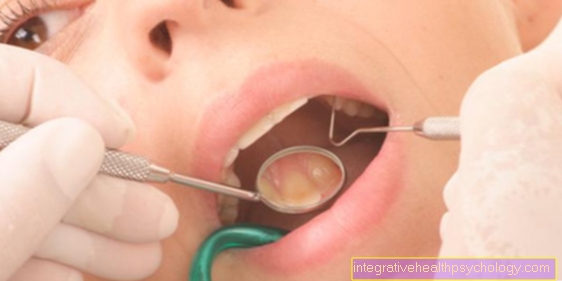 Fistula on the gums