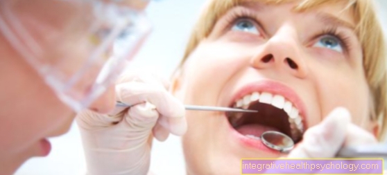 Zubní kaz