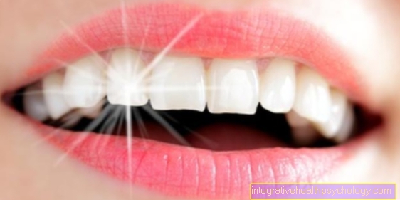 Професионално почистване на зъбите: колко често е необходимо?
