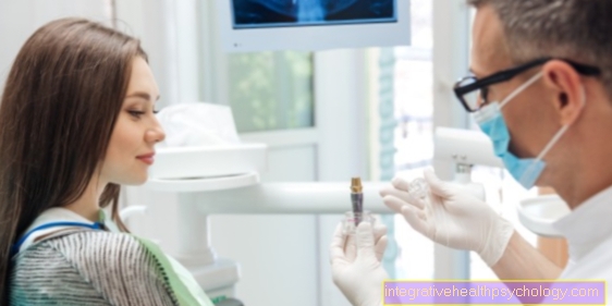 Rizika zubního implantátu